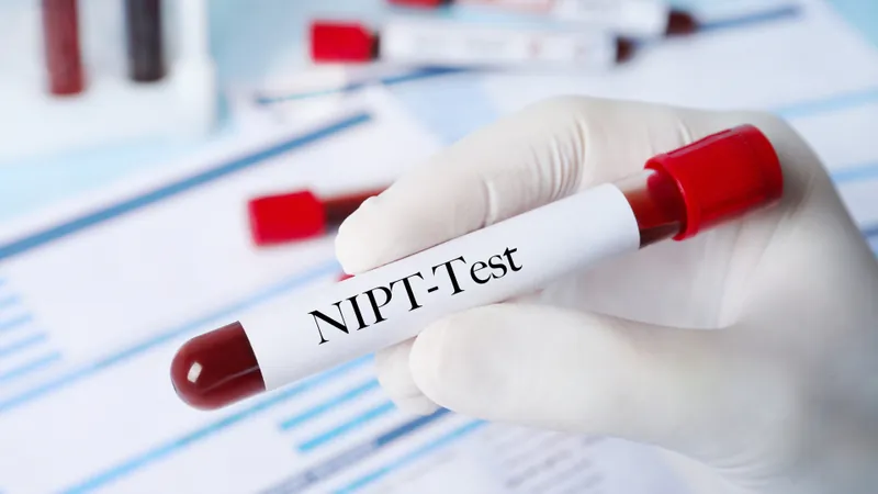 NIPT là gì? Có nên làm xét nghiệm NIPT không?